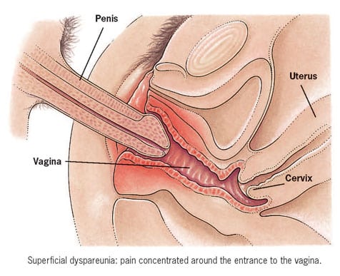 Pictures Of Vaginal Penetration 4